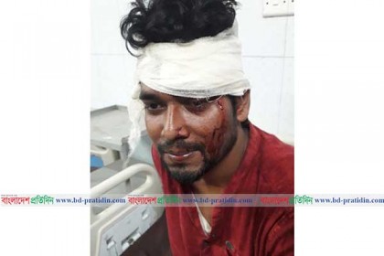 শাবিতে প্রতিপক্ষের হামলায় ছাত্রলীগ কর্মী আহত