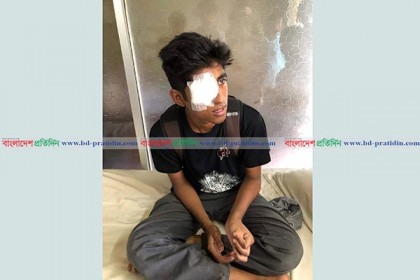 অধিভুক্তি বাতিলের আন্দোলনে যাওয়া দুই শিক্ষার্থীকে পেটাল ছাত্রলীগ