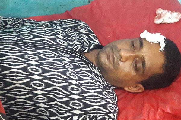 ধারালো অস্ত্রের আঘাতে ঠাকুরগাঁও প্রেসক্লাবের সাধারণ সম্পাদক আহত 