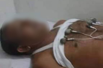 ঠাকুরগাঁওয়ে আওয়ামী লীগ নেতাকে মারপিটের অভিযোগ