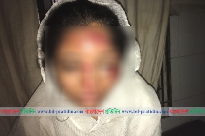 অটোরিকশা থেকে লাফিয়ে রক্ষা পেল কলেজছাত্রী