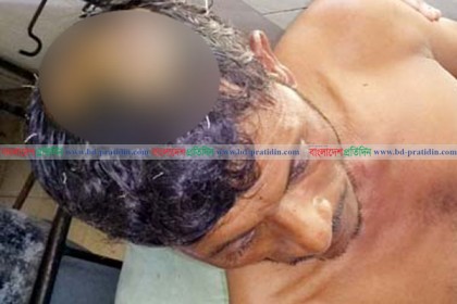 গুরুদাসপুরে যাত্রীবেশে চালককে কুপিয়ে ভ্যান ছিনতাই