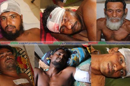 বোয়ালমারীতে সাউন্ড বক্স বাজানো নিয়ে সংঘর্ষ, আহত ৩০