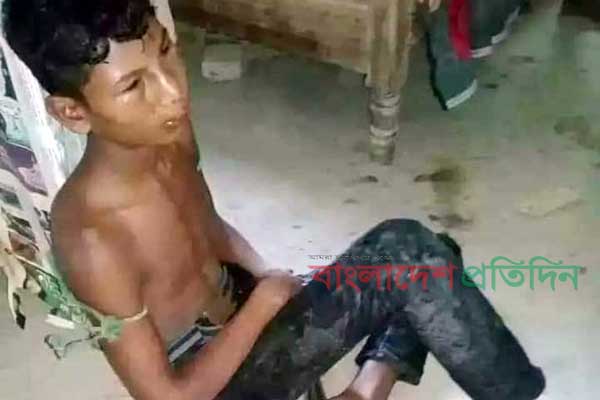 প্রেমিকার ভাইয়ের হাতে নির্যাতিত কিশোরের মৃত্যু