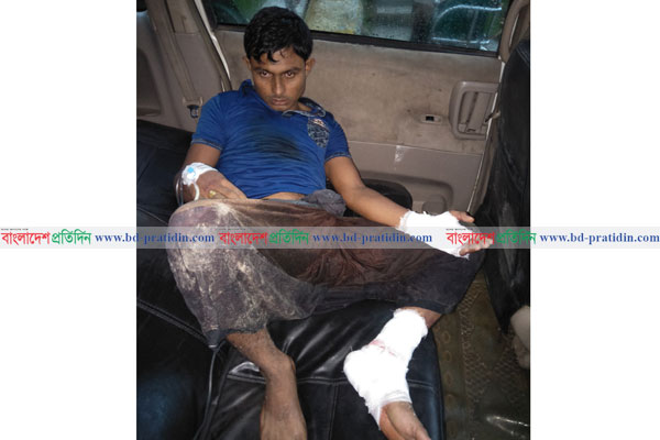 টেকনাফে যুবকের পায়ের রগ কাটল সন্ত্রাসীরা