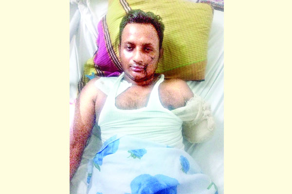 ১৫-২০ জন মিলে কুপিয়ে হাত কেটে নিয়েছে আমার