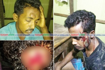 একটি চায়ের কাপের মালিকানা নিয়ে সংঘর্ষ, আহত ৬