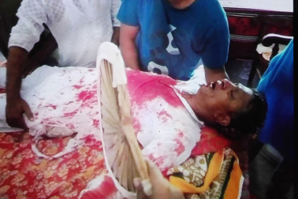 নাগরপুরে আওয়ামী লীগ নেতাসহ ৫ জনকে কুপিয়ে জখম, পুলিশ মোতায়েন