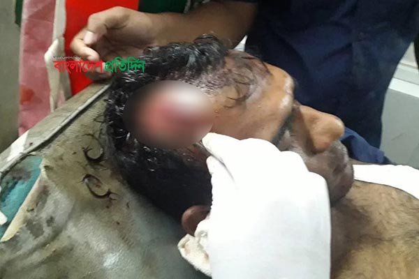বাকেরগঞ্জে ৬টি স্বর্ণের দোকানে ডাকাতি, হামলায় এএসআই গুরুতর আহত