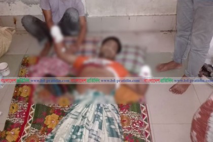যুবকের দু’হাতের কব্জি কেটে নিল সন্ত্রাসীরা
