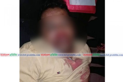 বাগেরহাটে সন্ত্রাসীদের গুলিতে ব্যবসায়ী নিহত