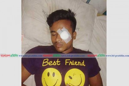 কলেজড্রেস না পড়ায় অধ্যক্ষের পিটুনি, চোখ ক্ষতিগ্রস্ত ছাত্রের