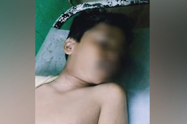 কার্টুন চরিত্রের নকল করতে গিয়ে স্কুলছাত্রের মৃত্যু