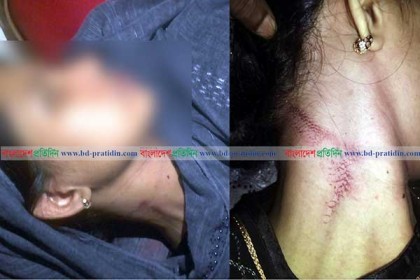 পরকীয়ায় দ্বিতীয় বিয়ের চেষ্টা, বাঁধা দেওয়ায় স্বামীর কাণ্ড!