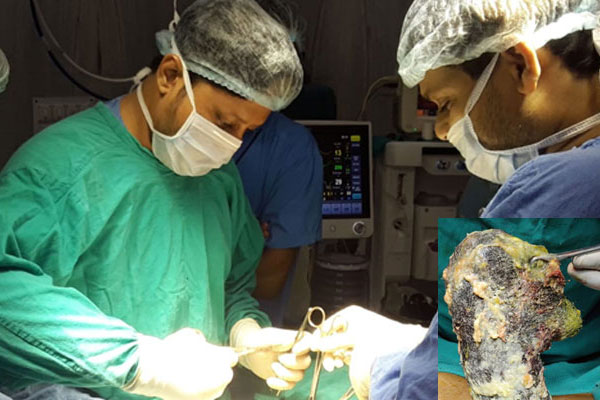 কিশোরীর পেট থেকে বের হল ১ কেজি চুল!
