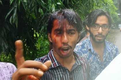 মদের বোতলে জাবি ছাত্রলীগ কর্মীর মাথা ফাটাল আরেক কর্মী