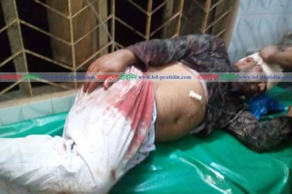 বিরামপুরে পৌর যুবলীগের সাধারণ সম্পাদকের ওপর দুর্বৃত্তের হামলা