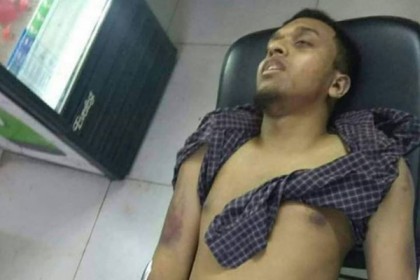 আবরারের দেহে অসংখ্য জখমের চিহ্ন, ময়নাতদন্ত শেষে চিকিৎসকরা