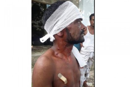 রংপুরে পুলিশ-এলাকাবাসী সংঘর্ষে রণক্ষেত্র, পুলিশ-ইউপি চেয়ারম্যানসহ আহত ২৫