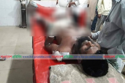 পূর্ব শত্রুতার জেরে পায়ের রগ কেটে দিলো প্রতিপক্ষের লোকজন