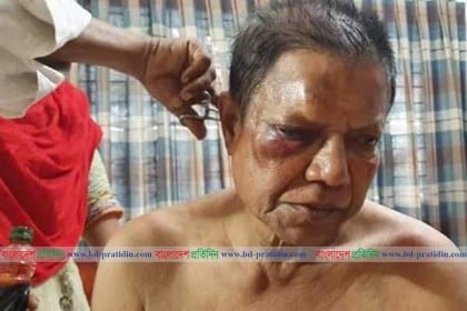 নাটোরে বিএনপি নেতার উপর হামলা