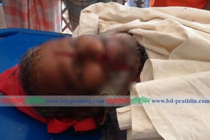 কলাপাড়ায় সড়ক দুর্ঘটনায় পিতার মৃত্যু, ২ ছেলে আহত