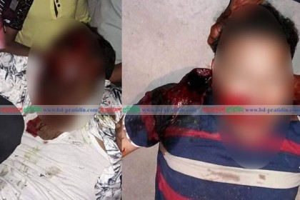 আসামিকে নিয়ে আসার সময় দুর্ঘটনায় ২ পুলিশ নিহত