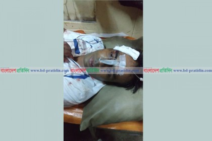 খুলনায় পুলিশের সোর্সকে কুপিয়ে গুরুতর জখম