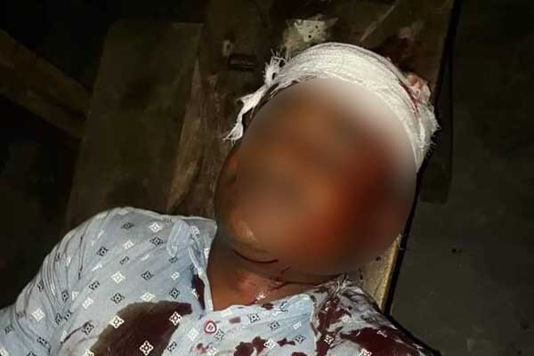 কলেজে হামলা চালিয়ে নৈশপ্রহরীকে কুপিয়ে জখম, গাড়ি ভাংচুর