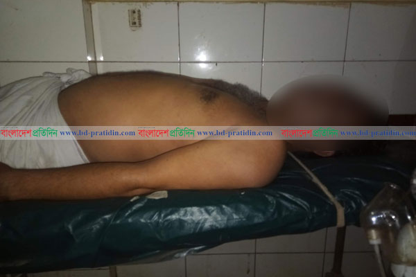 ব্রাহ্মণবাড়িয়ায় যৌন উত্তেজক ওষুধ খেয়ে একজনের মৃত্যু