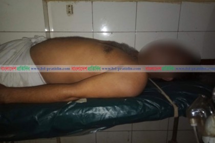 ব্রাহ্মণবাড়িয়ায় যৌন উত্তেজক ওষুধ খেয়ে একজনের মৃত্যু