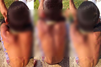 গাছের সঙ্গে বেঁধে শিশু নির্যাতনের ঘটনায় বাবা-ছেলে গ্রেফতার