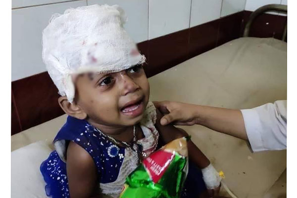 স্বজনদের খুঁজছে আহত সেই শিশুটি