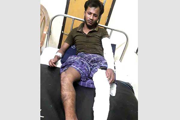 বেগমগঞ্জে ইউপি চেয়ারম্যানের পিটুনিতে যুবক আহত