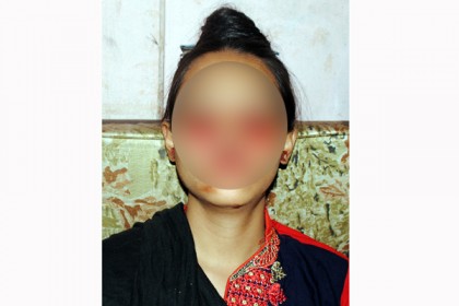 চোখ দিয়ে রক্ত পড়ে অনবরত, বাঁচতে চায় ঝুমুর