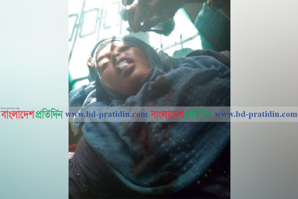প্রতিবাদ করায় ইট দিয়ে ছাত্রীর ৫টি দাঁত ভাঙল বখাটে