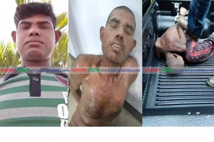 মালয়েশিয়ায় পুলিশি নির্যাতনে কারাবন্দী বাংলাদেশি প্রবাসীর জীবন সঙ্কটাপন্ন