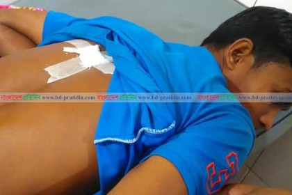শৈলকুপায় আওয়ামী লীগের দুই গ্রুপের সংঘর্ষে আহত ৫ 