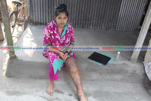 পায়ের জন্য স্বপ্ন ভঙ্গ শাম্মীর