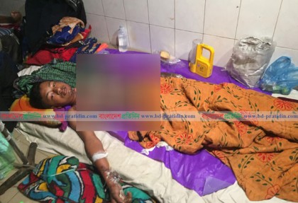 ৬ শ’ টাকা নিয়ে বিরোধের জেরে ৭ম শ্রেণির ছাত্রকে পুড়িয়ে হত্যার চেষ্টা
