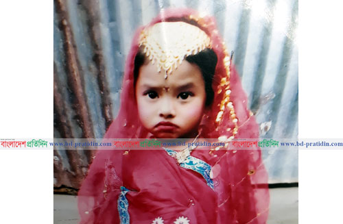 বগুড়ায় আগুনে পুড়ে শিশুর মৃত্যু 