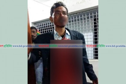 মুলাদীতে দুর্বৃত্তের হামলায় ইউপি সদস্য গুরুতর আহত 