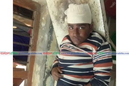 ক্লাস ফাঁকি দিতে গিয়ে ছাদ থেকে পড়ে এসএসসি পরীক্ষার্থী আহত