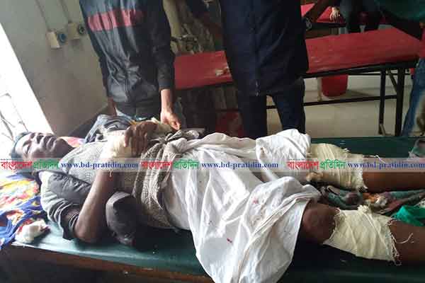 বাগেরহাটে সন্ত্রাসী হামলায় আওয়ামী লীগ নেতা আহত