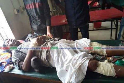 বাগেরহাটে সন্ত্রাসী হামলায় আওয়ামী লীগ নেতা আহত