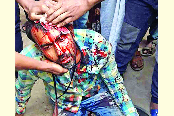 সাংবাদিকদের ওপর হামলা হয়রানি