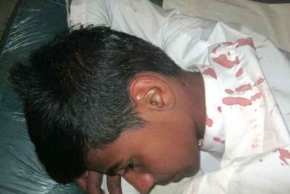 বরিশালে স্কুলছাত্রকে কুপিয়ে জখম
