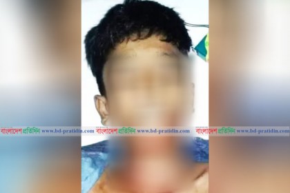 কুমিল্লায় ক্রিকেট খেলাকে কেন্দ্র করে ছুরিকাঘাতে কিশোর খুন