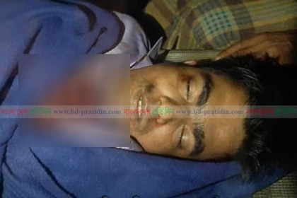 বিয়ের ৩ দিনের মাথায় ডাকাতের গুলিতে প্রবাসী যুবক নিহত