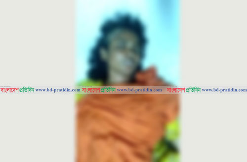 স্ত্রীর মাথার চুল কেটে আগুন দিল স্বামী 